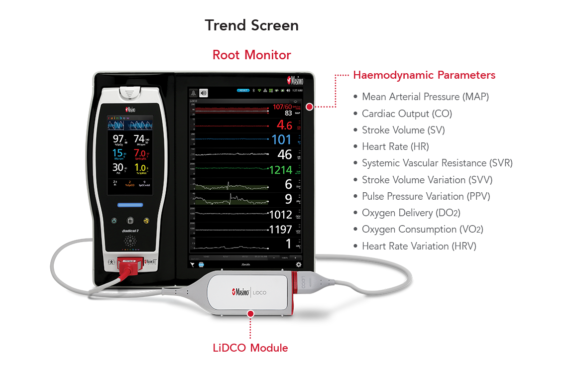 Key Features of LiDCO on Root Display Monitor