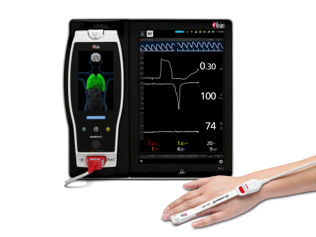patient hand equiped with ORi next to Masimo Root Device