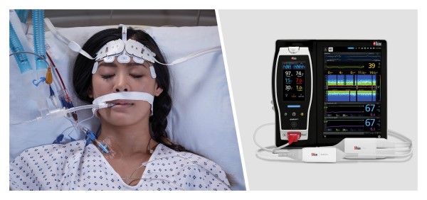 patient in bed with masimo root brain monitors placed on forehead. adjacent product shot of  Masimo Root with Rad-7 sedline and 03 monitors
