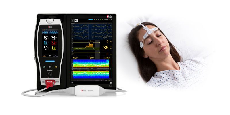 Masimo SedLine® Brain Function Monitoring