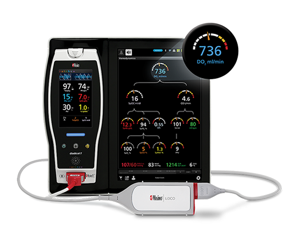 Masimo Radical-7 patient monitor with LiDCO module displaying hemodynamic measurements.