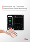 Masimo - Noninvasive and Continuous Haemoglobin (SpHb) Monitoring