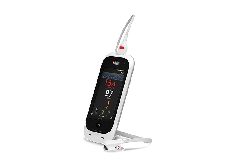 Masimo - Rad-67 Portable and Versatile Pulse CO-Oximetry