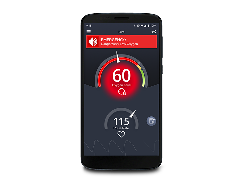 Masimo SafetyNet Alert app showing emergency screen