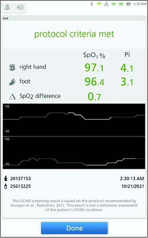 Masimo - Eve automatic synchronisation algorithm 