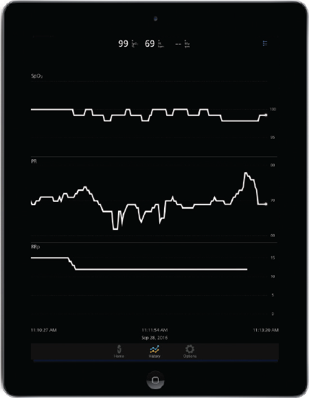 Masimo - Trend Data on Masimo Professional Health App