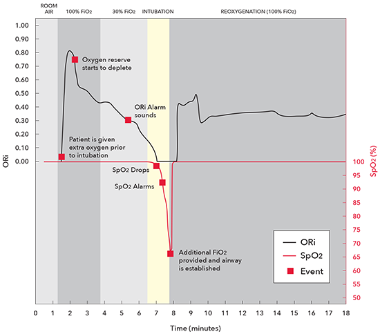 Masimo - ORi - Clinical Application Graph