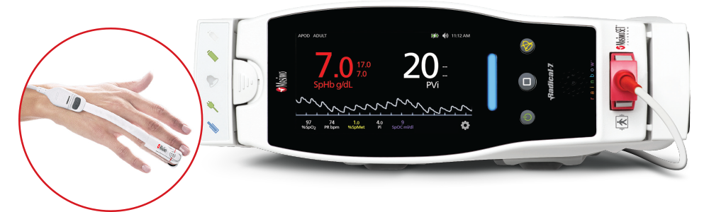 Masimo - Pleth Variability Index (PVi)