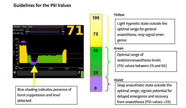 Masimo - PSi Guidelines