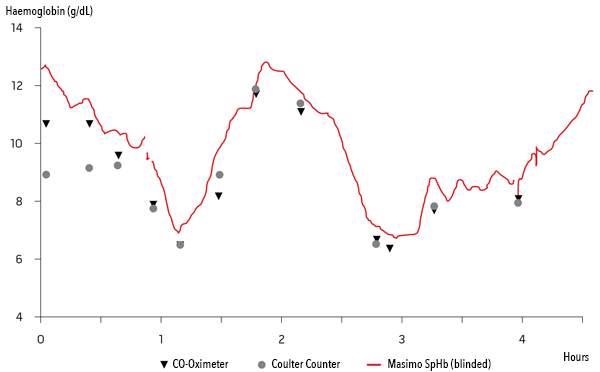 Masimo - SpHb - Clinical Case Graph