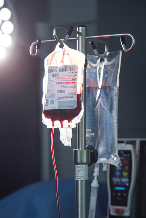 Masimo - Blood bag on an IV stand in OR