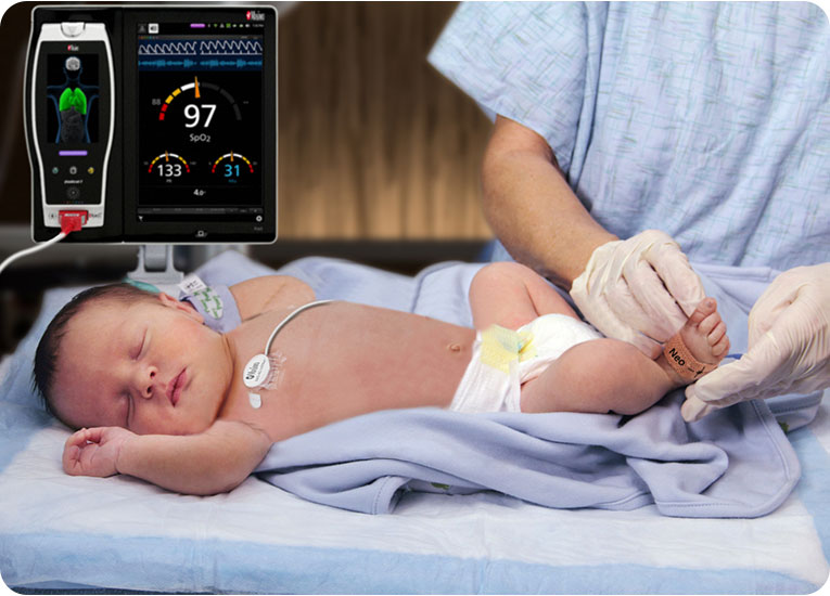 Masimo - infant in medical bed with sensor on foot