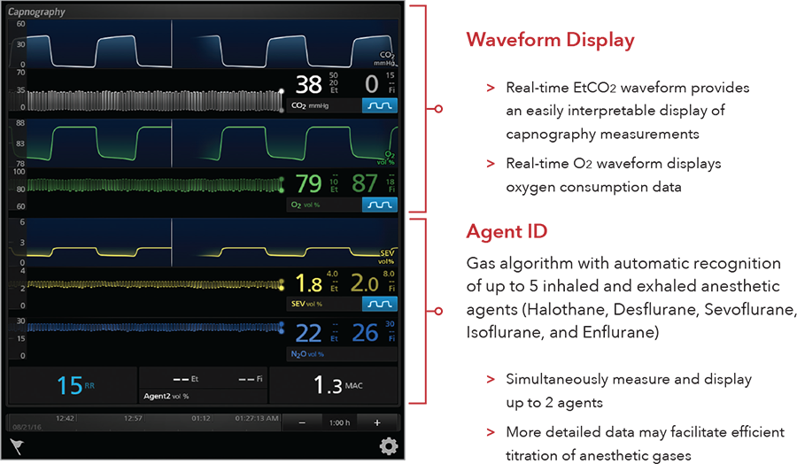 UI screen displaying waveforms on the Masimo Root