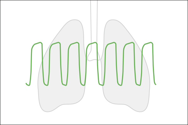 NomoLine with Luer - Unique design sampling line