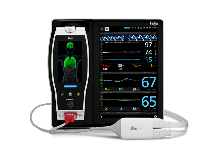 Masimo - O3® regional oximetry