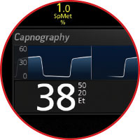 Masimo - Rad-97 with Capnography