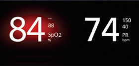 Masimo - Radical-7 feature Audible and visual Alarms