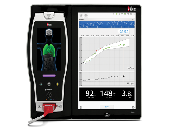 Masimo Root with Pathway