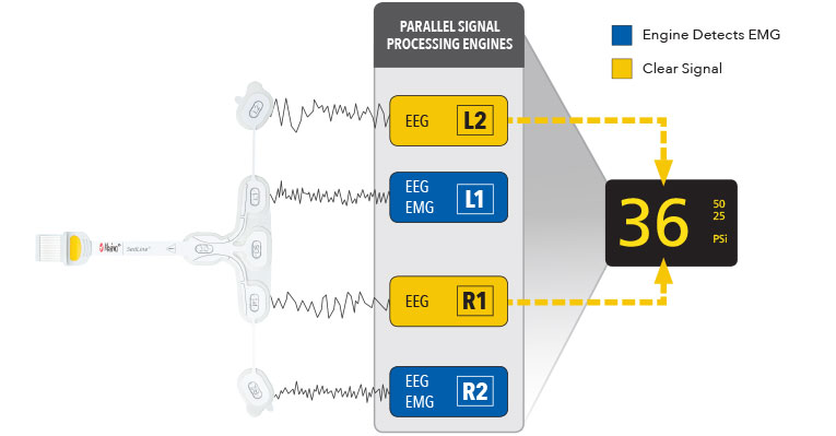 Masimo - Moteurs de traitement du signal en parallèle