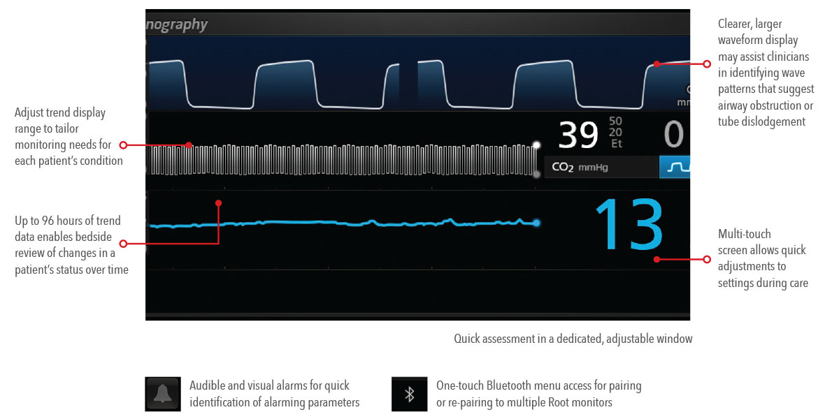 Masimo - Supplemental Capnography Display on Root with call outs