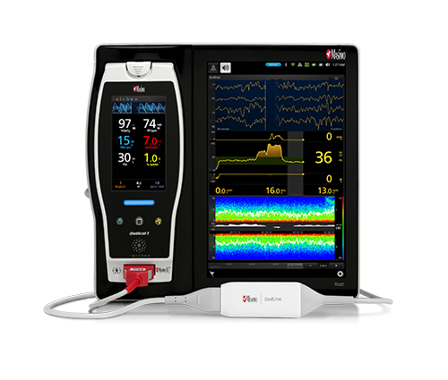 Masimo - Root with SedLine Brain Function Monitoring