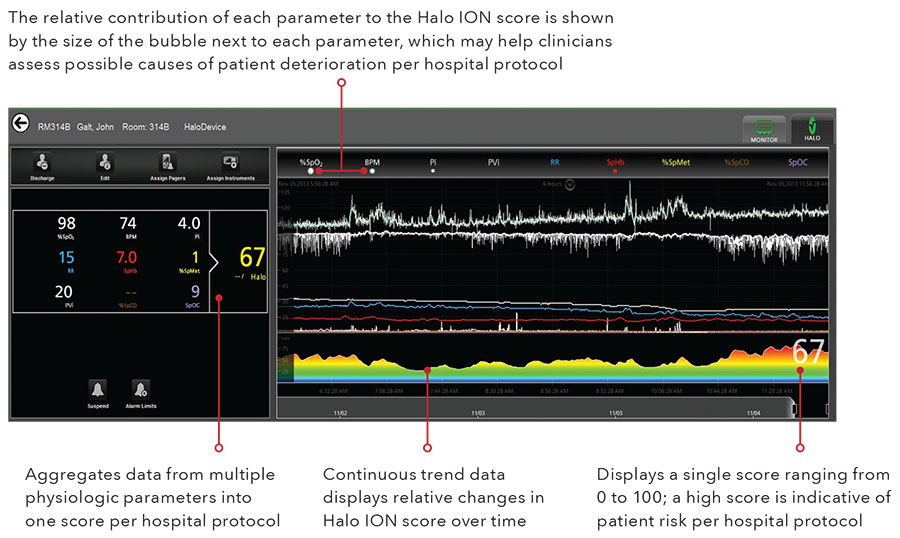 Masimo - An Automated, Personalized, Continuous Patient Score